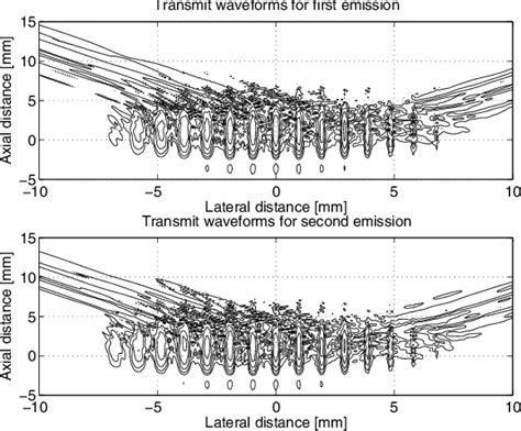 Simulation of advanced ultrasound systems using Field II .